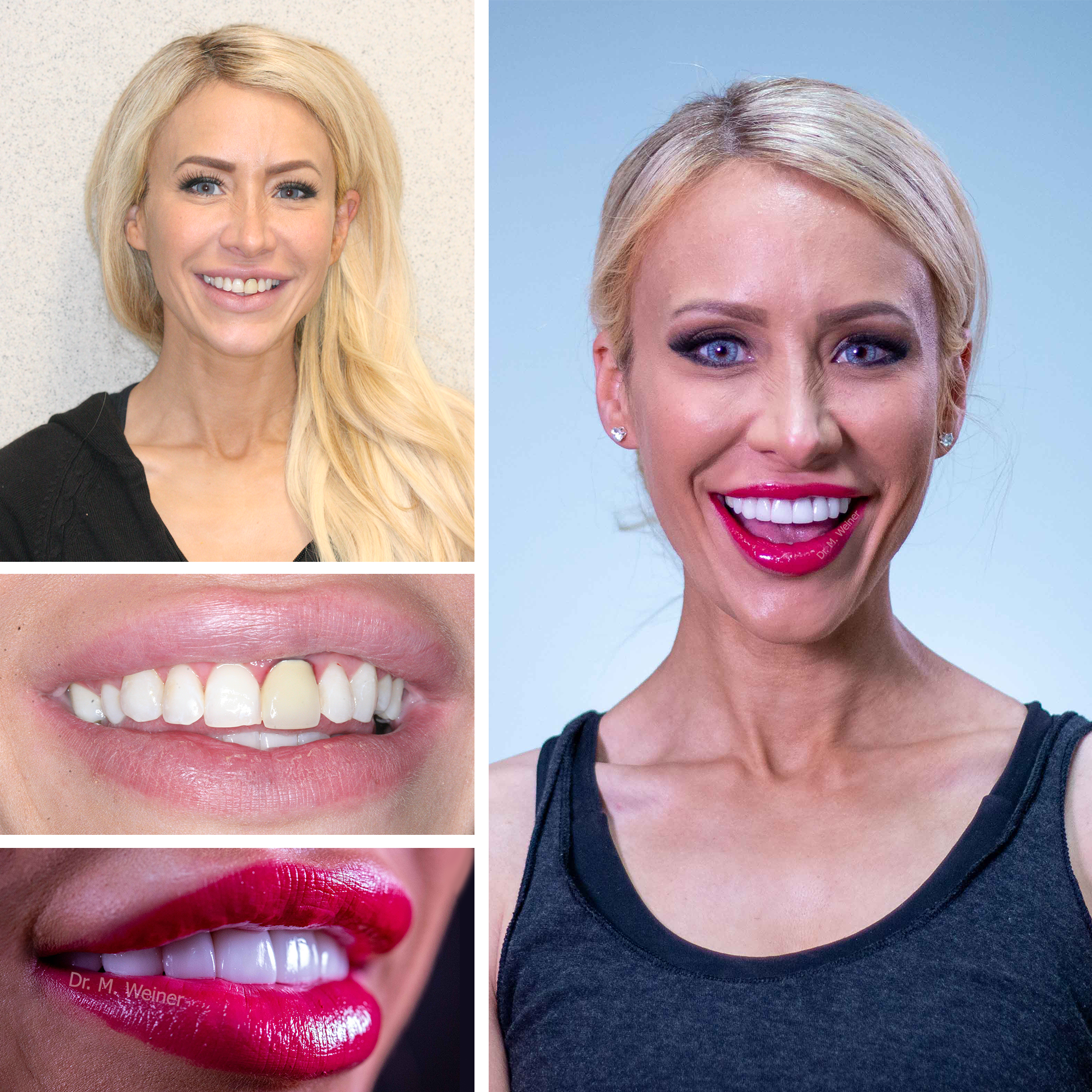 Cosmetic Before After