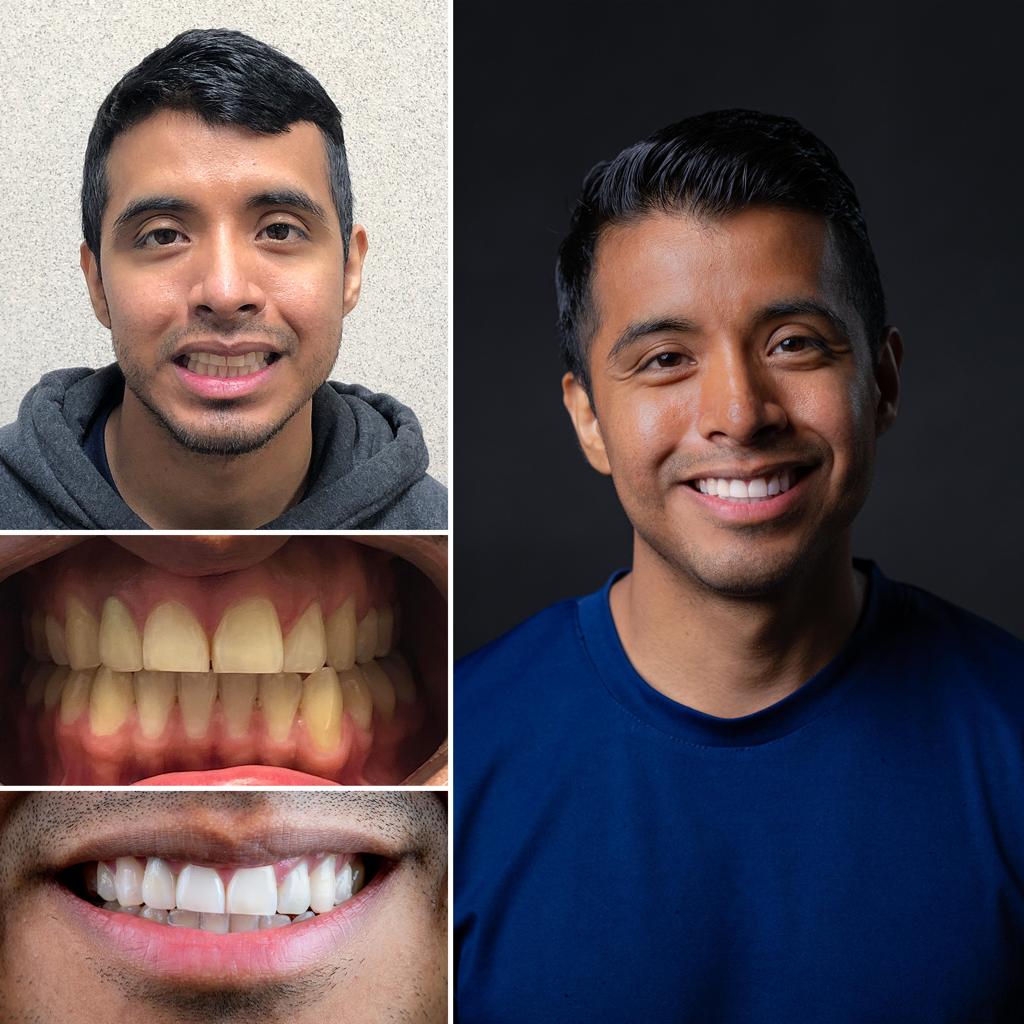 Cosmetic Before After