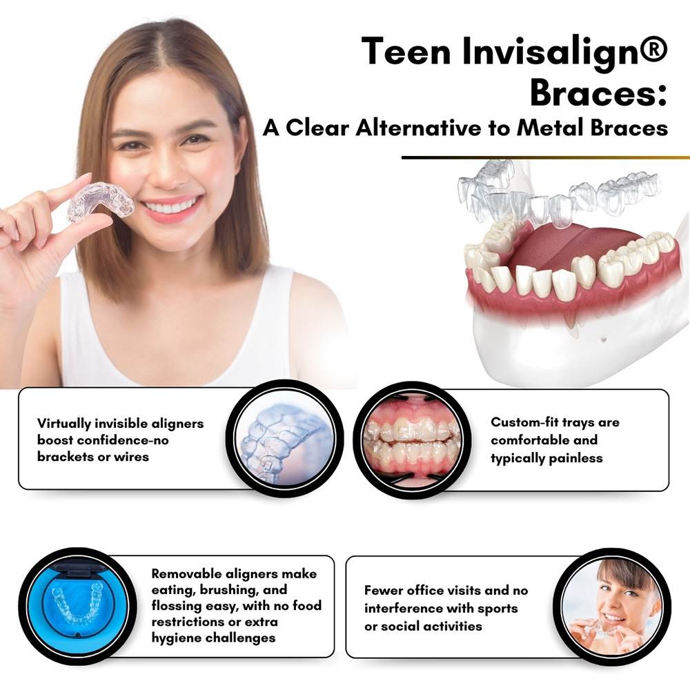 Teen Invisalign Braces