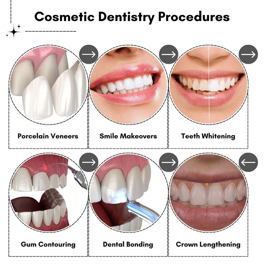 Cosmetic Dentistry Procedures in Brooklyn